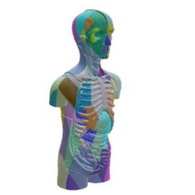 MedShapeNet: A large-scale dataset of 3D medical shapes for computer vision