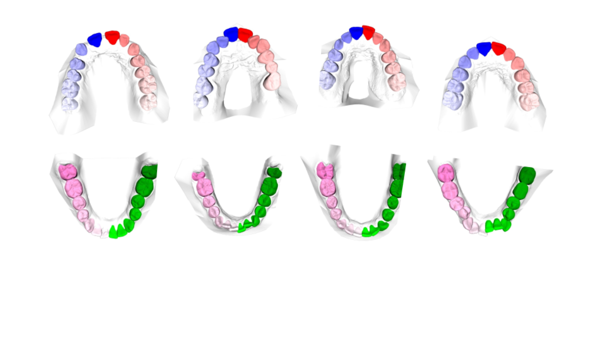Teeth3DS: A benchmark for teeth segmentation and labeling from intra-oral 3D scans