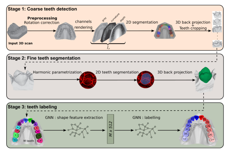 TSegLab: Multi-stage 3D dental scan segmentation and labeling